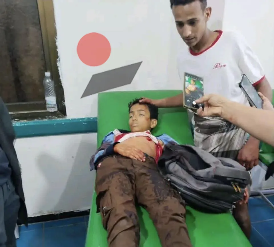 تعز: مليشيات الحوثي تقنص طفلاً أثناء عودته من المدرسة تعز: مليشيات الحوثي تقنص طفلاً أثناء عودته من المدرسة