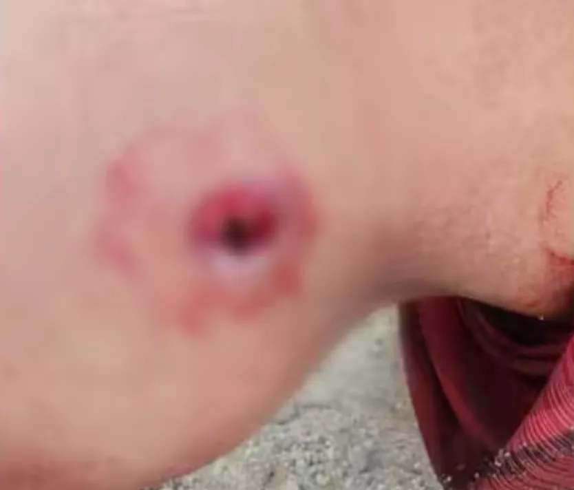 تعز... إصابة امرأة برصاص قناص حوثي في جبل حبشي تعز... إصابة امرأة برصاص قناص حوثي في جبل حبشي