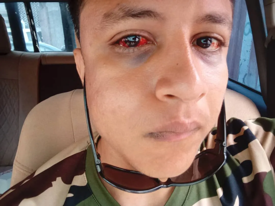 واقعة تعذيب شاب داخل شرطة البريقة تثير موجة غضب ومطالب بالتحقيق