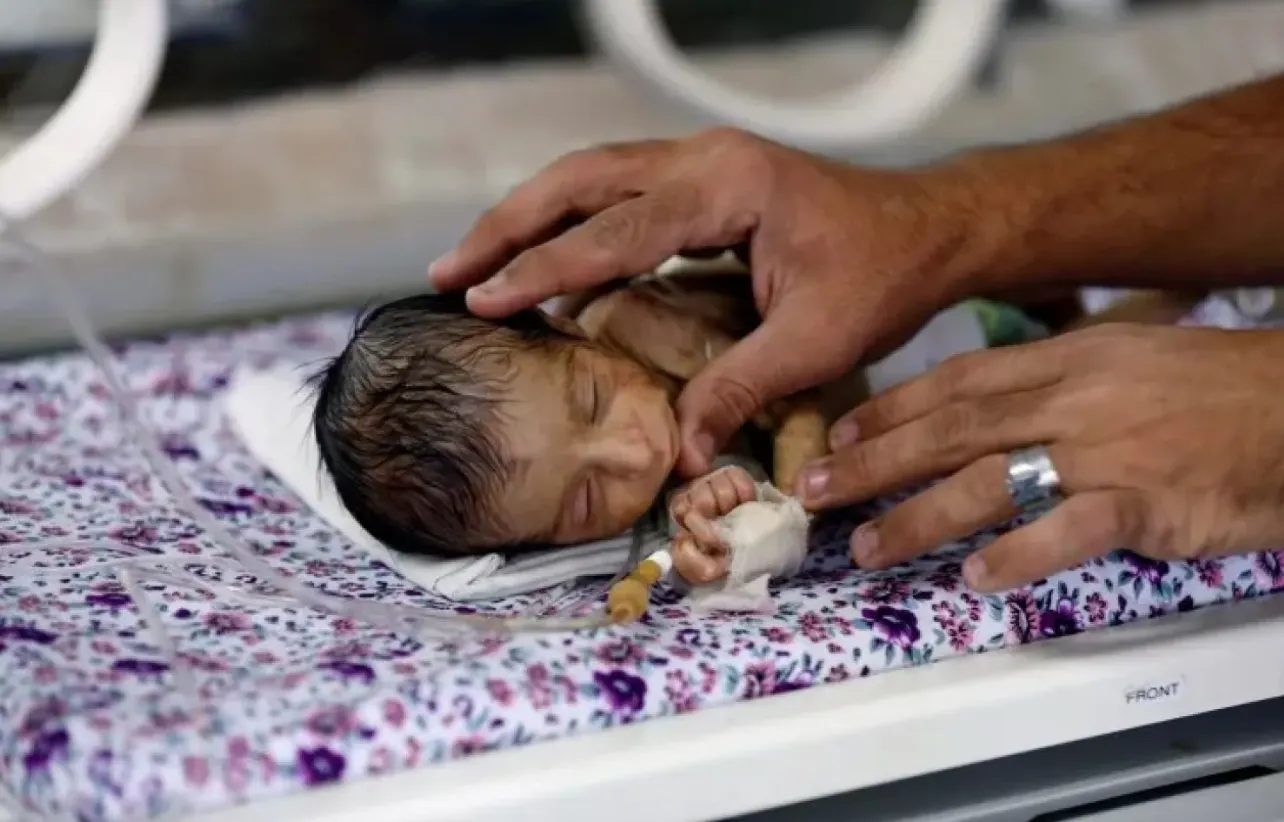 الأوبئة في اليمن تقاوم نظاماً صحياً يعيش في حالة طوارئ الأوبئة في اليمن تقاوم نظاماً صحياً يعيش في حالة طوارئ