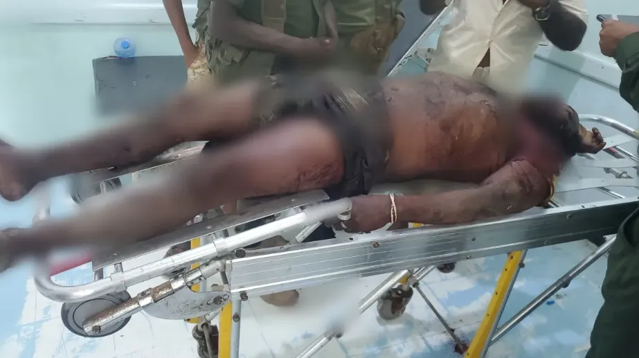 الحديدة.. مقذوف من مخلفات مليشيا الحوثي يودي بحياة مواطن في مديرية الخوخة