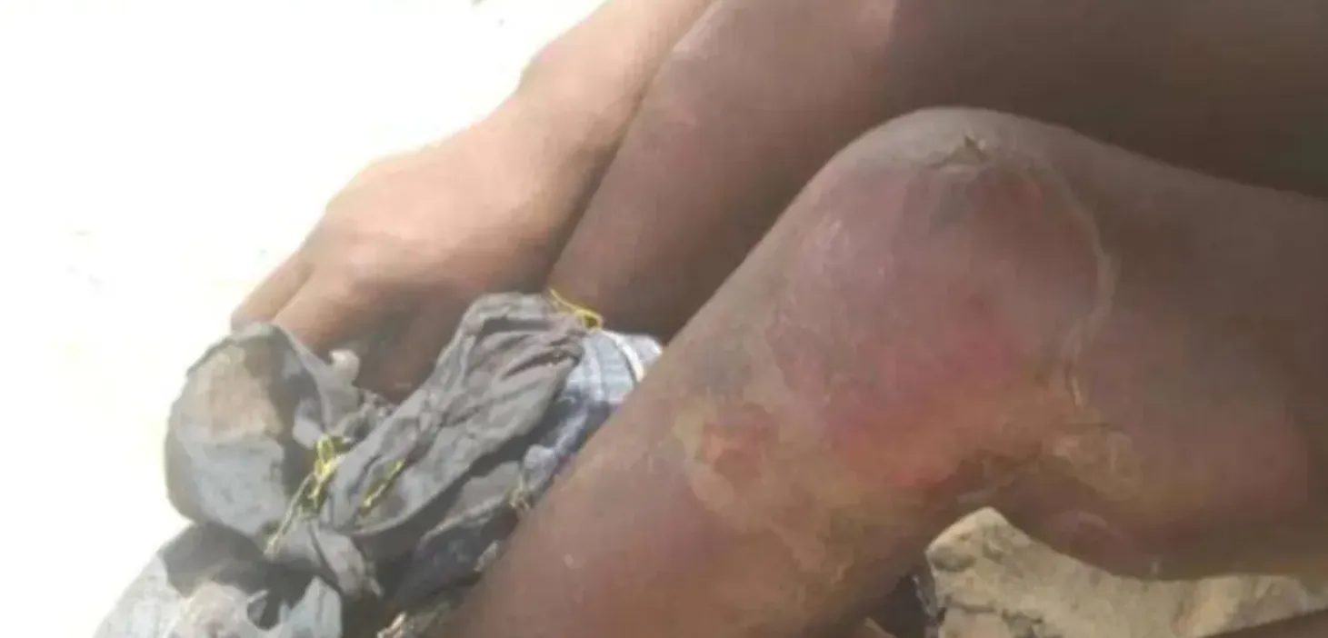 شيخ قبلي في أبين يحذر من "معتقلات سرية" لتعذيب مهاجرين ويدعو لتحرك عاجل