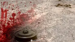 تقرير حقوقي: الألغام الحوثية تقتل وتصيب آلاف المدنيين خلال 9 سنوات وتخلف إعاقات دائمة