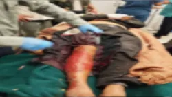 قناص حوثي يقتل مسنًا في تعز ضمن سلسلة جرائم متواصلة بحق المدنيين