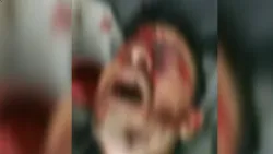 قتيل وثلاثة جرحى في اشتباكات قبلية بعمران