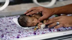 الأوبئة في اليمن تقاوم نظاماً صحياً يعيش في حالة طوارئ